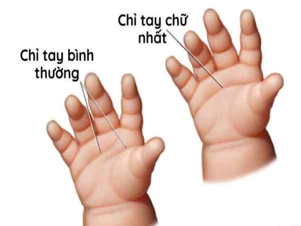 Về tình duyên và hôn nhân nữ