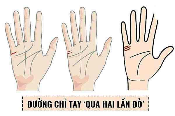 Có nhiều đường chỉ tay hôn nhân