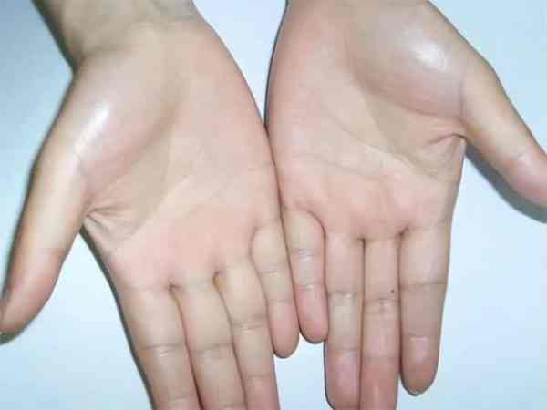 4 đường chỉ tay hiếm gặp