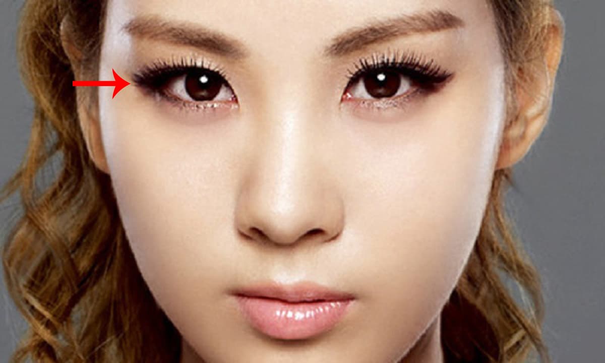 Mắt tròng đen nhiều hơn tròng trắng là gì? Mắt tròng đen nhiều hơn tròng trắng là gì?