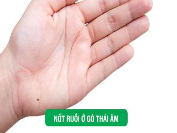 Ý nghĩa nốt ruồi ở gò Thái Âm tay trái