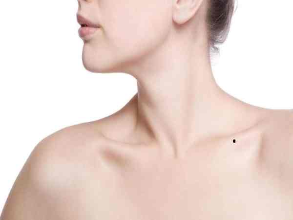 Nốt ruồi ở xương quai xanh nữ bên phải
